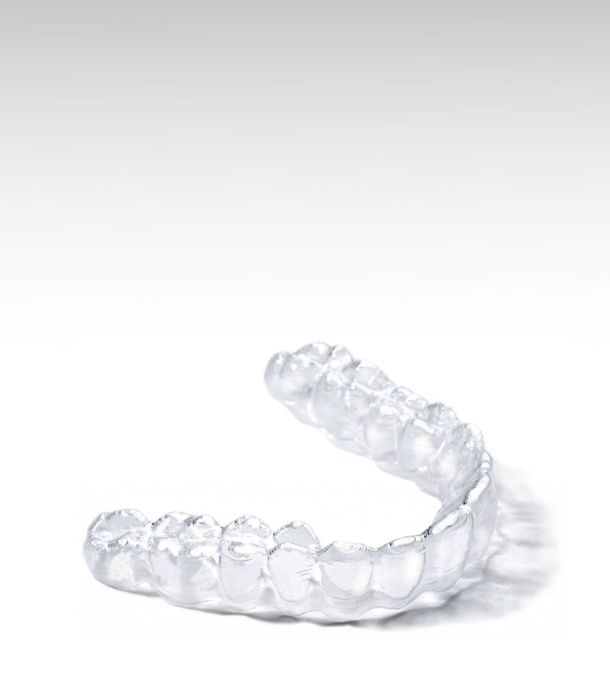 Clear Aligners