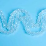 When to Change my clear aligners